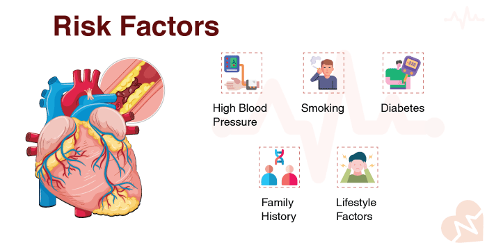 Increased heart attacks: An explanation of lifestyle, genetics, and novel risk factors