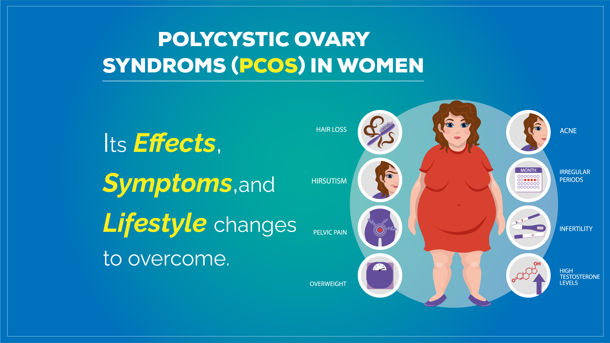Is PCOS inherited or a result of lifestyle choices?