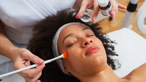 Why it's never a good idea to do a DIY chemical peel